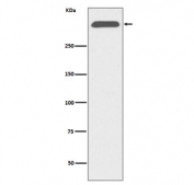 Western blot testing of human serum lysate with Apolipoprotein B antibody. Predicted molecular weight ~516 kDa.