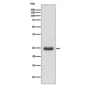 Western blot testing of human Molt4 cell lysate with TK1 antibody. Predicted molecular weight ~25 kDa.