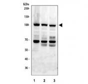 Western blot testing of human 1) 293T, 2) A549 and 3) PC-3 cell lysate with HERC5 antibody. Predicted molecular weight ~117 kDa.