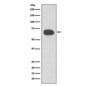Western blot testing of human skin lysate with CK1 antibody. Predicted molecular weight ~67 kDa.