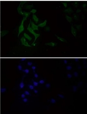 Immunofluorescent staining of human HeLa cells with GAPDH antibody (green) and DAPI nuclear stain (blue).