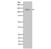 Western blot testing of human T-47D cell lysate with Progesterone Receptor antibody. Expected molecular weight: 82-94 kDa (PR-A) and 99-120 kDa (PR-B).