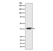 Western blot testing with POLB antibody. Predicted molecular weight ~38 kDa.
