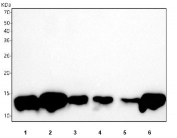 Western blot testing of 1) human HCCT, 2) human HCCP, 3) human HepG2, 4) rat liver, 5) rat RH35 and 6) mouse liver tissue lysate with FABP1 antibody. Predicted molecular weight ~14 kDa.