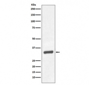 Western blot testing of human prostate carcinoma tissue lysate with PSA antibody. Predicted molecular weight: 30-34 kDa.
