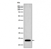 Western blot testing of human Jurkat cell lysate with Profilin 1 antibody. Predicted molecular weight ~15 kDa.