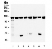 Western blot testing of rat 1) lung, 2) testis, 3) kidney, 4) brain, and mouse 5) lung, 6) testis and 7) kidney lysate with ATP Citrate Lyase antibody. 