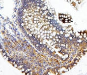 IHC staining of FFPE rat intestine with CDC42 antibody. HIER: boil tissue sections in pH8 EDTA for 20 min and allow to cool before testing.