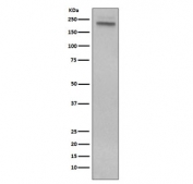 Western blot testing of human Jurkat cell lysate with CD45 antibody. Expected molecular weight: 147-220 kDa depending on glycosylation level.