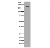 Western blot testing of human 293 cell lysate with c-Met antibody. Predicted molecular weight ~156 kDa.