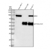Immunoprecipitation of EZH2 protein from 500ug of human MCF7 whole cell lysate with 2ug of EZH2 antibody.