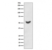 Western blot testing of human HeLa cell lysate with KRT7 antibody. Predicted molecular weight ~51 kDa.