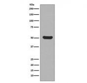Western blot testing of human HaCat cell lysate with Cytokeratin 16 antibody. Predicted molecular weight ~51 kDa.