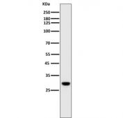 Western blot testing of mouse spleen lysate with Heme Oxygenase 1 antibody. Predicted molecular weight ~32 kDa.