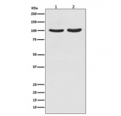 Western blot testing of human 1) T-47D and 2) LNCaP cell lysate with Androgen Receptor antibody. Predicted molecular weight ~99 kDa.