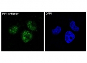Immunofluorescent staining of FFPE human HeLa cells with IRF1 antibody (green) and DAPI nuclear stain (blue). HIER: steam section in pH6 citrate buffer for 20 min.