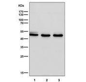 Western blot testing of human 1) A549, 2) NCI-H1299 and 3) HUVEC lysate with HAPLN1 antibody at 1:1000. Expected molecular weight: 41-48 kDa depending on glycosylation level.