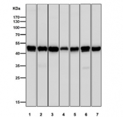 Western blot testing of 1) mouse liver, 2) mouse spleen, 3) mouse brain, 4) rat heart, 5) rat liver, 6) rat kidney and 7) rat brain tissue lysate with HAPLN1 antibody at 1:1000. Expected molecular weight: 41-48 kDa depending on glycosylation level.