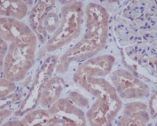 IHC staining of FFPE human kidney tissue with HAPLN1 antibody at 1:50. HIER: boil tissue sections in pH6 citrate buffer for 20 min and allow to cool before testing.