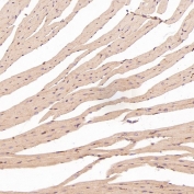 IHC staining of FFPE mouse heart tissue with HAPLN1 antibody at 1:50. HIER: boil tissue sections in pH6 citrate buffer for 20 min and allow to cool before testing.