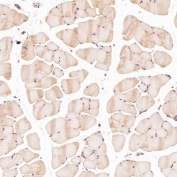 IHC staining of FFPE mouse skeletal muscle tissue with HAPLN1 antibody at 1:50. HIER: boil tissue sections in pH6 citrate buffer for 20 min and allow to cool before testing.