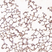 IHC staining of FFPE rat liver tissue with HAPLN1 antibody at 1:50. HIER: boil tissue sections in pH6 citrate buffer for 20 min and allow to cool before testing.