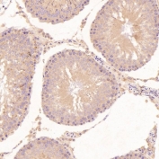 IHC staining of FFPE rat testis tissue with BiP antibody. HIER: boil tissue sections in pH6, 10mM citrate buffer, for 10-20 min followed by cooling at RT for 20 min.