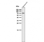 Western blot testing of mouse liver tissue lysate with BiP antibody. Predicted molecular weight: ~73 kDa, but routinely observed at 70-78 kDa.