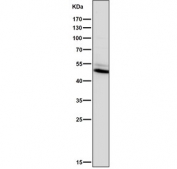 Western blot testing of human Saos-2 cell lysate with Vitamin D Receptor antibody. Predicted molecular weight 48/54 kDa (isoforms 1/2).