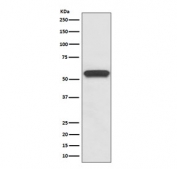 Western blot testing of rat brain lysate with Aromatase antibody. Predicted molecular weight ~58 kDa.