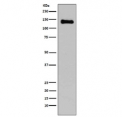 Western blot testing of rat C6 cell lysate with E-Cadherin antibody. Expected molecular weight: 135 kDa (precursor), 80-120 kDa (mature, depending on glycosylation level).