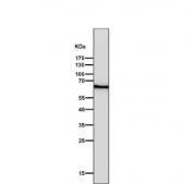 Western blot testing of human HaCaT cell lysate with Keratin 5 antibody. Predicted molecular weight: 58-62 kDa.