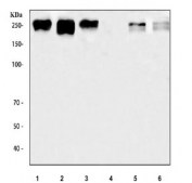 Western blot testing of 1) human HepG2, 2) human HeLa, 3) human 293T, 4) human Jurkat, 5) rat brain and 6) mouse brain tissue lysate with ROBO1 antibody. Expected molecular weight: 181-250 kDa depending on level of glycosylation.
