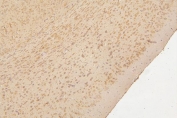 HIER: boil tissue sections in pH8 EDTA for 20 min and allow to cool before testing.HIER: boil tissue sections in pH6, 10mM citrate buffer, for 20 min and allow to cool before testing.