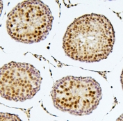 IHC staining of FFPE rat testis with SOX15 antibody. HIER: boil tissue sections in pH6, 10mM citrate buffer, for 20 min and allow to cool before testing.