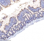 IHC staining of FFPE rat small intestine tissue with EpCAM antibody. HIER: boil tissue sections in pH8 EDTA for 20 min and allow to cool before testing.
