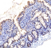 IHC staining of FFPE rat small intestine tissue with EpCAM antibody. HIER: boil tissue sections in pH8 EDTA for 20 min and allow to cool before testing.