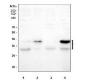 Western blot testing of 1) human Caco-2, 2) human MCF7, 3) rat small intestine and 4) mouse small intestine tissue lysate with EpCAM antibody. Expected molecular weight: ~35 kDa (unmodified), 40-43 kDa (glycosylated).