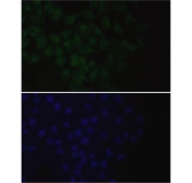 Immunofluorescent staining of FFPE human HeLa cells with EpCAM antibody (green) and DAPI nuclear stain (blue). HIER: steam section in pH6 citrate buffer for 20 min.