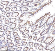 IHC staining of FFPE human colon tissue with EpCAM antibody. HIER: boil tissue sections in pH8 EDTA for 20 min and allow to cool before testing.