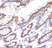 IHC staining of FFPE human colon tissue with EpCAM antibody. HIER: boil tissue sections in pH8 EDTA for 20 min and allow to cool before testing.