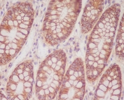 IHC staining of FFPE human colon tissue with CD46 antibody. HIER: boil tissue sections in pH6, 10mM citrate buffer, for 10-20 min and allow to cool before testing.