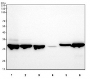 Western blot testing of 1) human A549, 2) human HepG2, 3) human MCF7, 4) human SH-SY5Y, 5) rat RH35 and 6) rat C6 cell lysate with NQO1 antibody. Predicted molecular weight ~30 kDa.