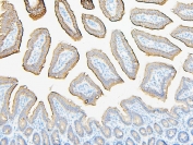 IHC staining of FFPE mouse intestine with ABCB5 antibody. HIER: boil tissue sections in pH6, 10mM citrate buffer, for 20 min and allow to cool before testing.