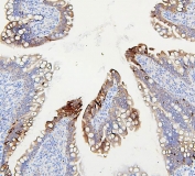 IHC staining of FFPE rat intestine with ABCB5 antibody. HIER: boil tissue sections in pH6, 10mM citrate buffer, for 20 min and allow to cool before testing.