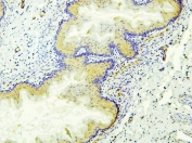 IHC staining of FFPE rat stomach with ALDH1A1 antibody. HIER: boil tissue sections in pH6, 10mM citrate buffer, for 20 min and allow to cool before testing.