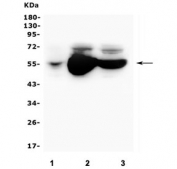 Western blot testing of human 1) placenta, 2) A549 and 3) HepG2 lysate with ALDH1A1 antibody. Expected molecular weight ~55 kDa.