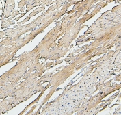 IHC staining of FFPE rat heart with SDHB antibody. HIER: boil tissue sections in pH6, 10mM citrate buffer, for 20 min and allow to cool before testing.
