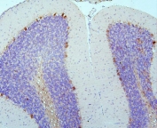 IHC staining of FFPE rat brain with DCC antibody. HIER: boil tissue sections in pH6, 10mM citrate buffer, for 20 min and allow to cool before testing.