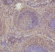 IHC staining of FFPE mouse spleen with PAX5 antibody. HIER: boil tissue sections in pH6, 10mM citrate buffer, for 20 min and allow to cool before testing.